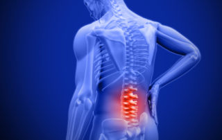 Back Pain-Somerton Physiotherapy