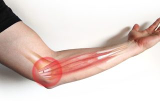 Golfers elbow-Somerton Physiotherapy Dublin